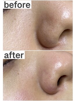 プルティティア 池下 今池 覚王山(Pultitia)/