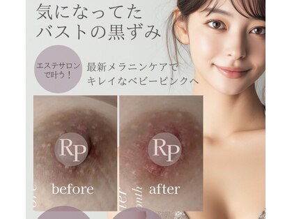 ルミアリュクス(LUMIA LUXE)の写真