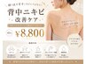 背中美人【IPL背中ニキビ改善ケア】45分　￥8800