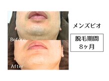 メンズビオ 神戸三宮店/