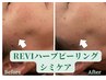 【シミケア】REVIハーブピーリング　美容液1週間分付き　¥19800→14300