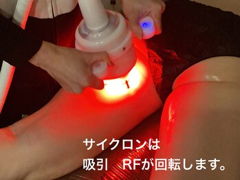 マッチ(much)/サイクロン　吸引・高周波・捻り