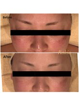 ラキア 五位堂駅前店(Ra kia)/シミケア