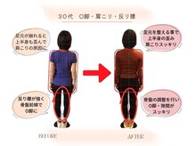 ストレッチ 整体 ホープ(HOPE)/30～40代女性にお薦め 美容整体