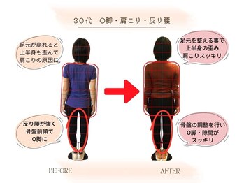 ストレッチ 整体 ホープ(HOPE)/30~40代女性にお薦め 美容整体