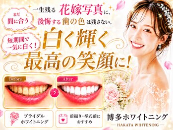 博多ホワイトニング福岡 博多駅前筑紫口店の写真/低価格!痛みが少ない!食事制限なし!セルフホワイトニングデビューしたい方に最適の丁寧なカウンセリング♪