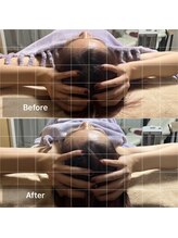 サン(SAN)/脳洗浄B/A