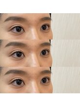 シアミス(SIAMIHS)/まつげパーマ