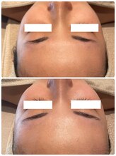 ディオーネ 春日井勝川店(Dione)/マーメイド☆ビフォーアフター