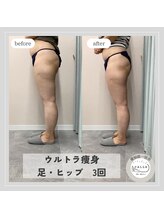 カラー(CALLA)/筋膜リリース×温め♪足/ヒップ