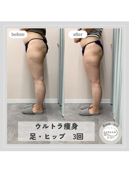 カラー(CALLA)/筋膜リリース×温め♪足/ヒップ