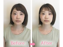 ナチュラルスペース アリエルの雰囲気（小顔矯正初回でむくみもすっきりリフトUP小顔へ♪）