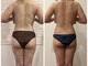 うつくし痩身 美サロン ゼットワン(Z-ONE)の写真/【体質を整える《筋膜リリース×痩身》】たぷたぷ二の腕を撃退♪華奢見せ上半身メディセル50分¥5800