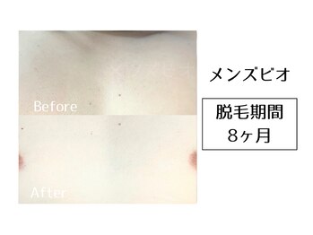 メンズビオ 神戸三宮店/