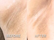 ドアディ(Doordie)/ローマピンク