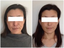 美容整体ウェリナ 名駅院/小顔矯正/骨盤矯正/美脚サロン