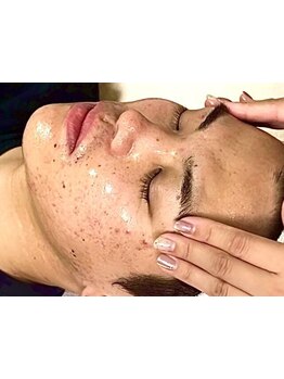 メンズフェイシャル