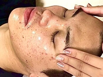 ビズビズ(bisebise)の写真/歳末新春SALE×学割U24\就活前に、何年も悩む肌荒れに終止符/ニキビケア赤み改善¥6800★リピート率97%