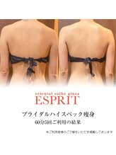 エスプリ 銀座店/二の腕・背中スリム・ブライダル