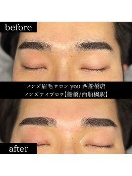 ユー 西船橋店(you)/ビフォーアフター写真