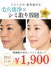 ★2026年最先端！毛穴洗浄×シミケア放題・滅！★(10分間ケア放題)1日2組限定
