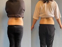 クリアリティ ボディ ケア(clearity body care)/2ヶ月間のビフォー＆アフター♪