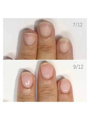 Rimo nail