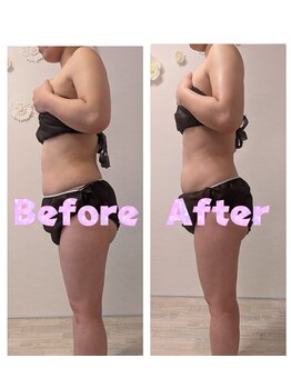 ムーンブロッサム(MoonBlossom)/上半身or下半身コース100分