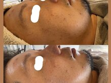 リノアンド(Lino&)/お肌をリフレッシュし元気に！