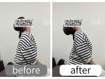 ナオル整体 大里院(NAORU整体)/40代女性 上を向く動作