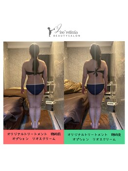 リノレリチア 心斎橋 新町店/