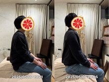 グレフル鍼灸接骨院 整体院 心斎橋/