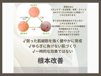 シエリー 原宿本店(Ciely)/ニキビの原因は？ニキビ根本改善