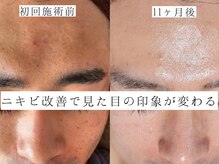 ユウビジン(YOU美人)/