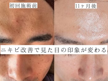 ユウビジン(YOU美人)/