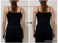 ソリ(soli)/before→after写真