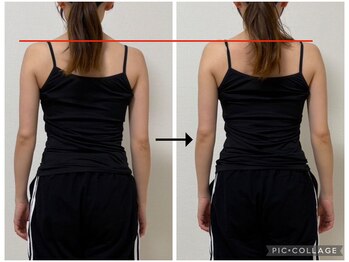 ソリ(soli)/before→after写真