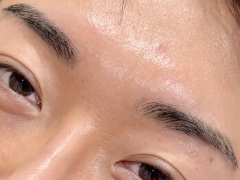 En.【4月4日OPEN(予定)】/施術イメージ