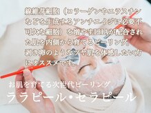 チップ(chip)/【ララピール/セラピール】