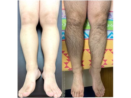 ソラ(SORA)の写真