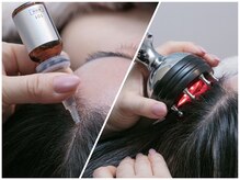 エルール トータルビューティ(Aileure total beauty)の雰囲気（頭皮と毛根の根本改善★ギャラリー観覧してみてください☆）