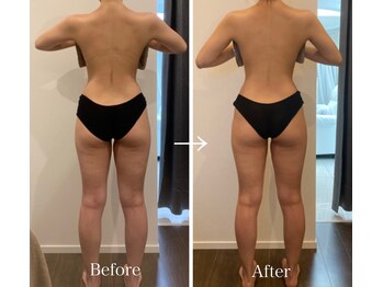 エニ 恵比寿(eni)/背面のビフォーアフター