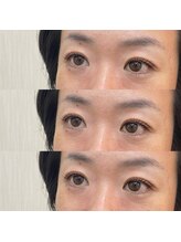 シアミス(SIAMIHS)/まつげパーマ