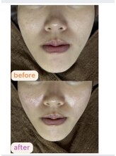 サクラ(SAKURA)/輪郭スッキリ♪