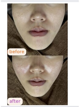 サクラ(SAKURA)/輪郭スッキリ♪