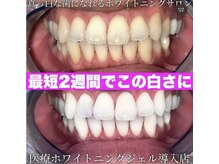 ホワイトサロン/3来店でこの結果に！