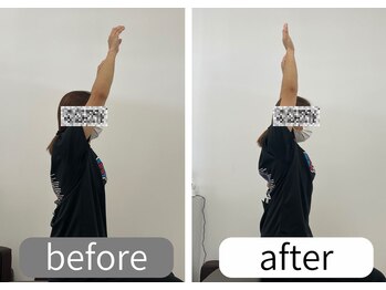 ナオル整体 大里院(NAORU整体)/30代女性 肩を上げる動作