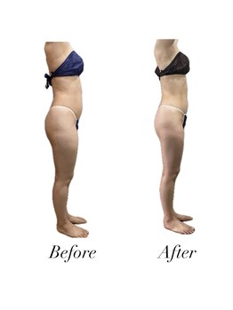 リノア(Lino'aka)/30代　○○さんの変化　痩ボディ