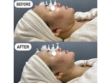 サロンドール(Salon doll)の雰囲気（毛穴レス小顔リフトなど色々なお悩みに対応◎【心斎橋エステ】）