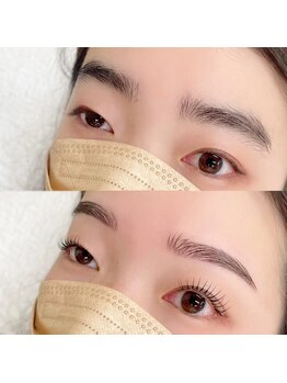 ラソ 県病院前店(lazo)/お客様before/after